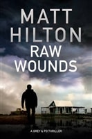 Raw Wounds | Hilton, Matt | Signed First Edition UK Book